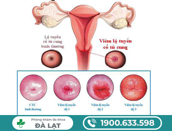 Hình ảnh minh họa